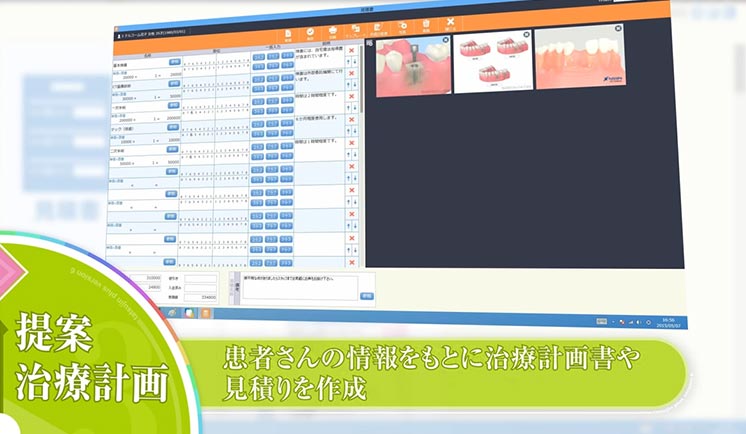 提案・治療計画