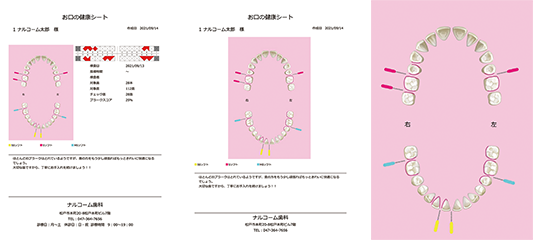 歯間ブラシ機能