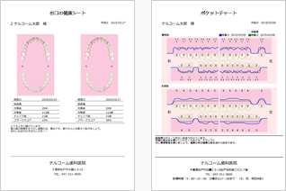 プラーク・ポケット比較