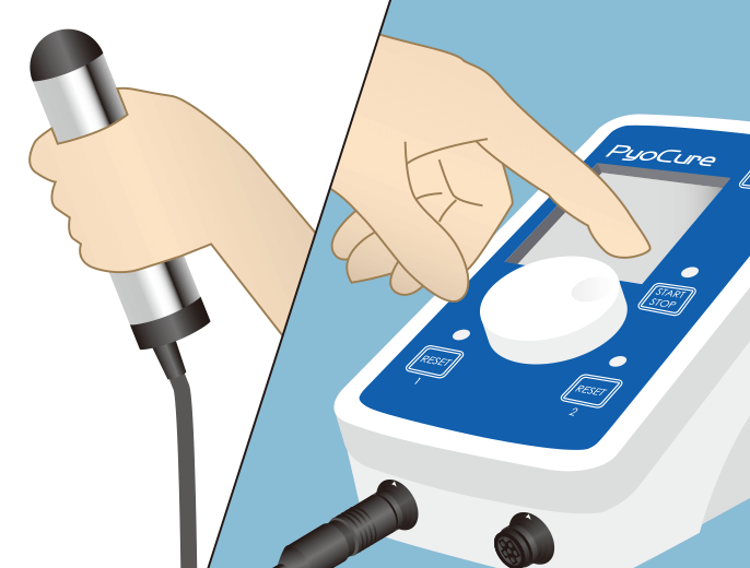 電極を患者さんの手にしっかりと握らせ、スイッチを押してイオン導入を行います。