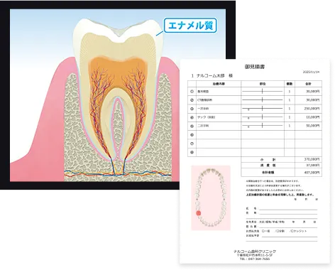 治療説明・提案