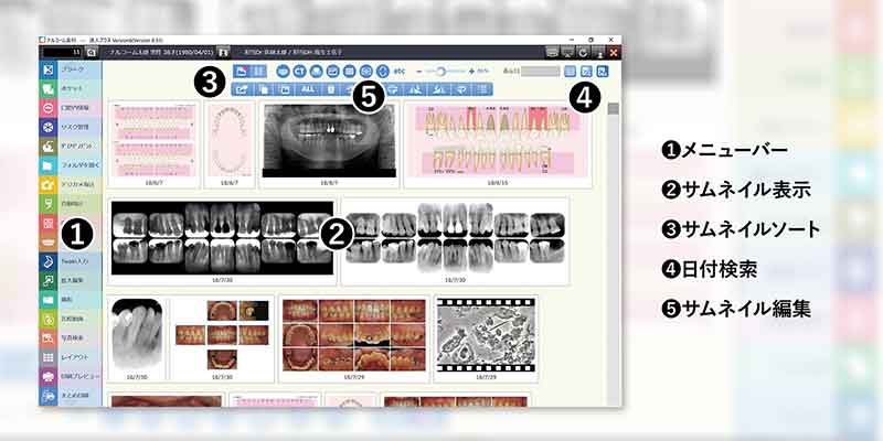 達人プラス 歯科医院用患者管理支援ソフト 歯周検査 画像 動画管理