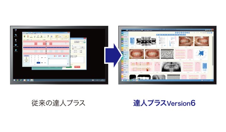 達人プラスversion6 歯科医院用患者管理支援ソフト 歯周検査 画像 動画管理