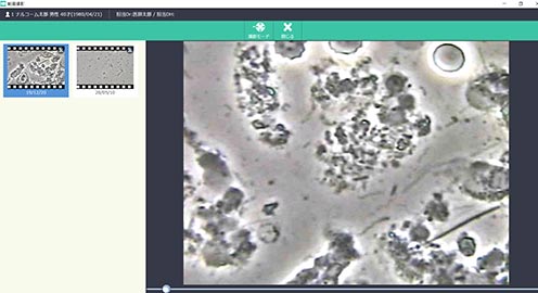 動画の撮影、位相差顕微鏡からの取り込みも可能