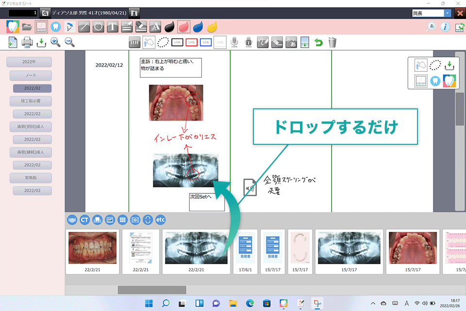 口腔内写真やレントゲン画像を簡単に貼り付け