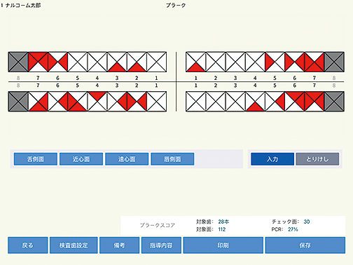 プラーク画面